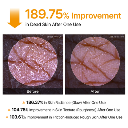 Body & Face Peel Shot Duo - Rice Peel Glow Ampoule & Kojic Acid Turmeric Spray